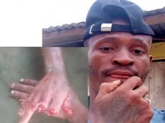 Oyem : Doigts tranchés à pour un cambriolage