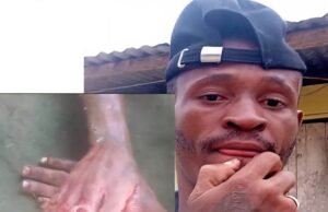 Oyem : Doigts tranchés à pour un cambriolage