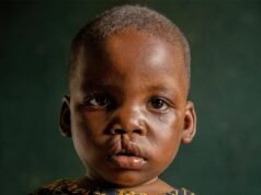 Santé Publique : Des Sourires Retrouvés