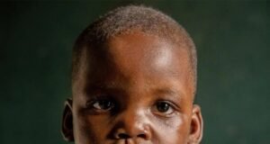 Santé Publique : Des Sourires Retrouvés