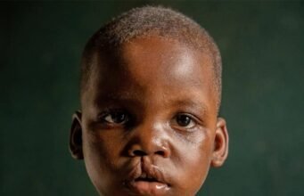 Santé Publique : Des Sourires Retrouvés