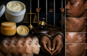 Dépigmentation : 5 ans de prison et 50 millions FCFA pour les vendeurs de “Kwanza”