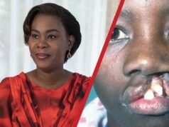Gabon : Zita Oligui Nguema lance une vaste opération gratuite pour soigner les enfants atteints de « becs de lièvre »