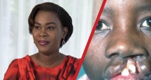 Gabon : Zita Oligui Nguema lance une vaste opération gratuite pour soigner les enfants atteints de « becs de lièvre »