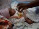 VIH pédiatrique au Gabon : 700 enfants identifiés sur 2 400 attendus