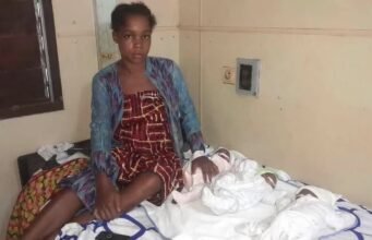 Mouila : mère de triplées, Jeanine confrontée aux frais de soins lance un appel à la solidarité